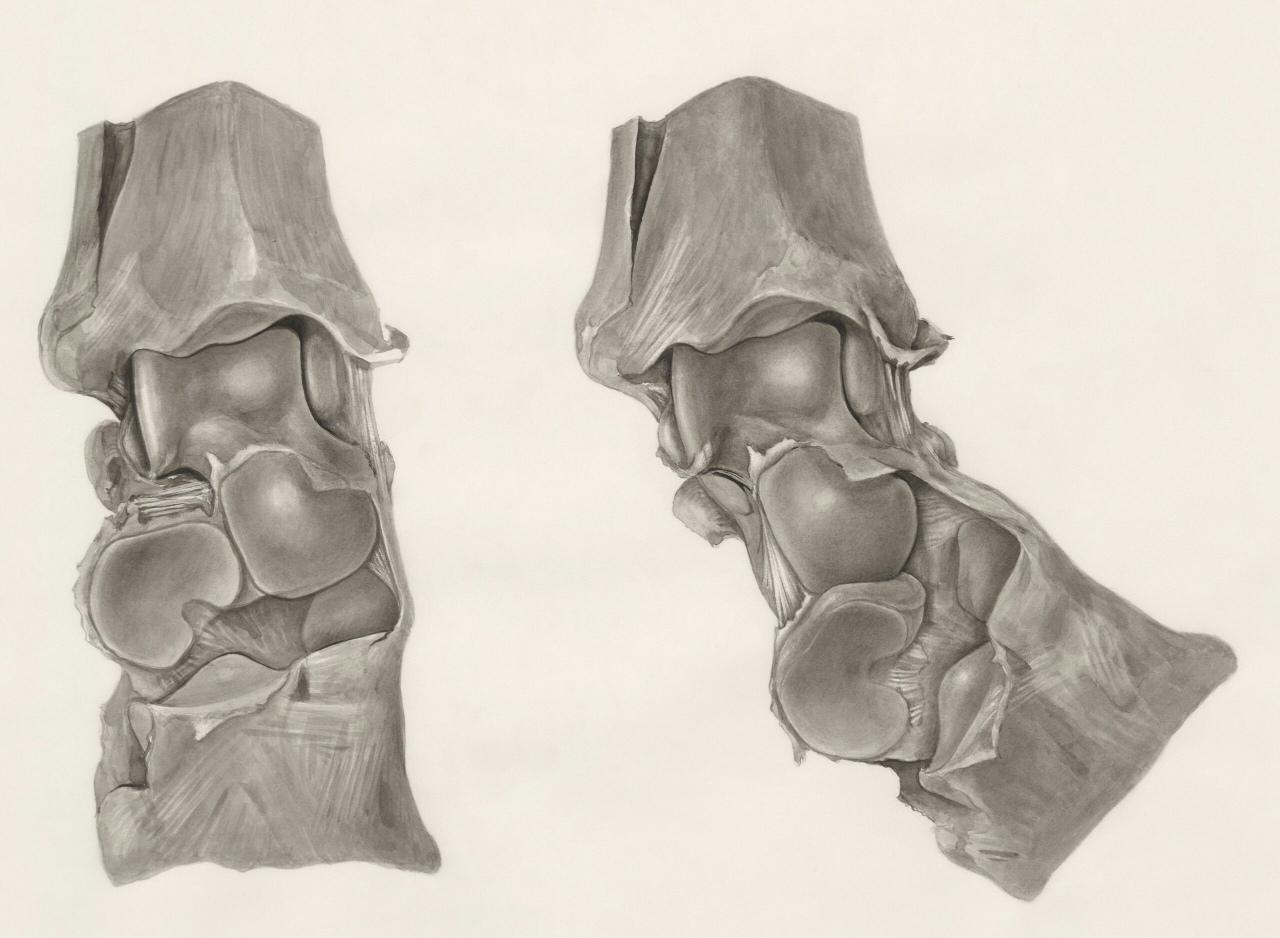 life expectancy after compression fracture